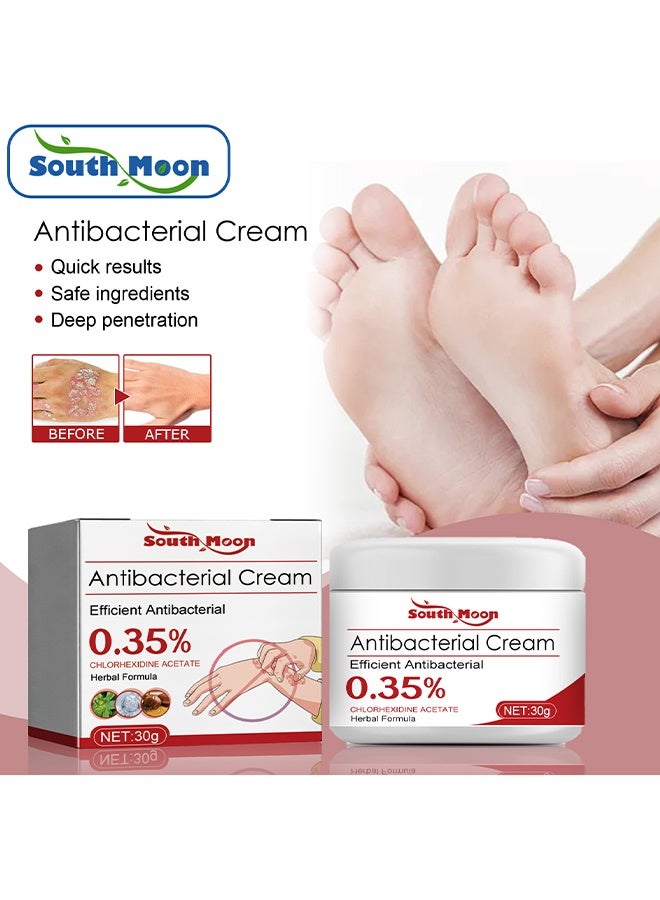 SOUTH MOON Antibacterial Cream, Psoriasis Cream, Natural Chinese Herbal Eczema Psoriasis Creams Dermatitis And Eczema Pruritus Psoriasis Ointment, Psoriasis Creams, Psoriasis Treatment, Antibacterial Cream, For Body Itching 30G - Image 2